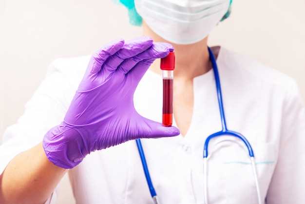 Алт и аст: что они обозначают в анализе крови?