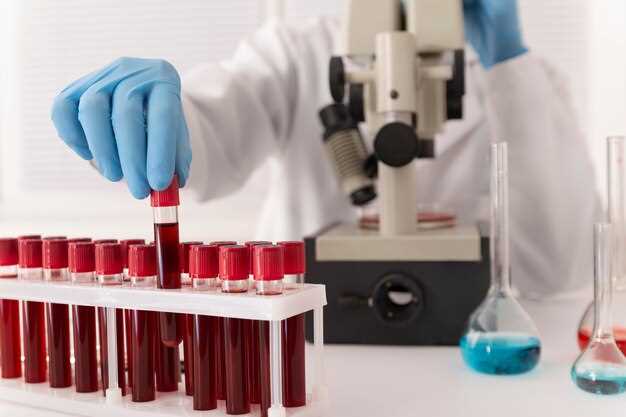 Результаты анализа на спид и вич в лаборатории крови: интерпретация и следующие шаги