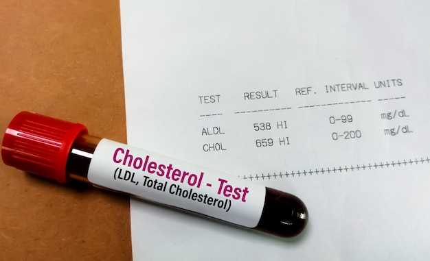 Как понять результат анализа холестерина