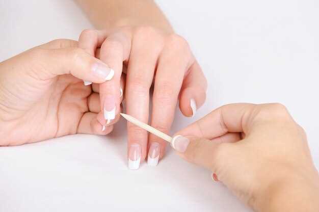 Причины появления белых полосок на ногтях у детей